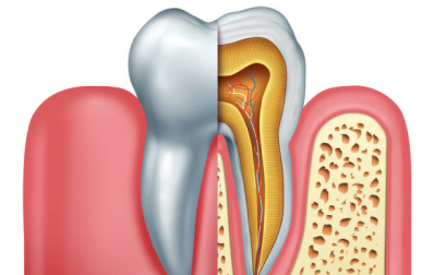 Conventional root canal treatment