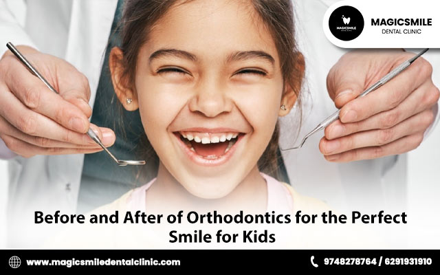 Before and After of Orthodontics for the Perfect Smile for Kids