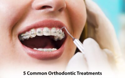 5 Common Orthodontic Treatments