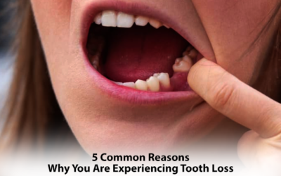 5 Common Reasons Why You Are Experiencing Tooth Loss