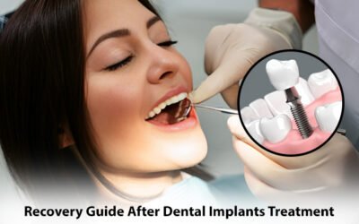 Recovery Guide After Dental Implants Treatment