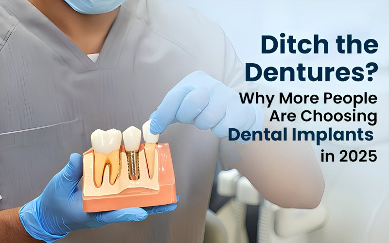 Ditch the Dentures? Why More People Are Choosing Dental Implants in 2025